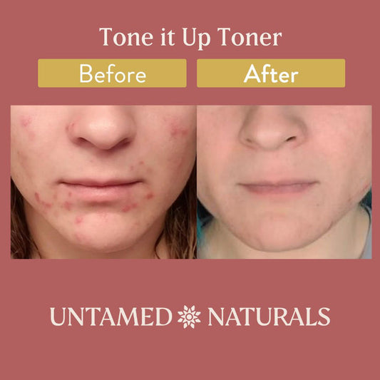 UnTamed Naturals Tone It Up! Toner
