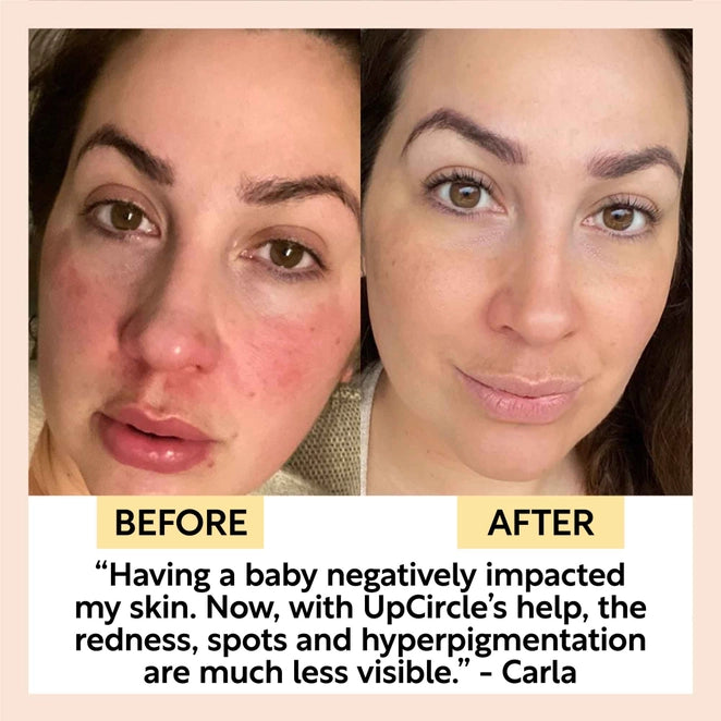 UpCircle Collagen Boosting Face Serum with Coffee and Rosehip