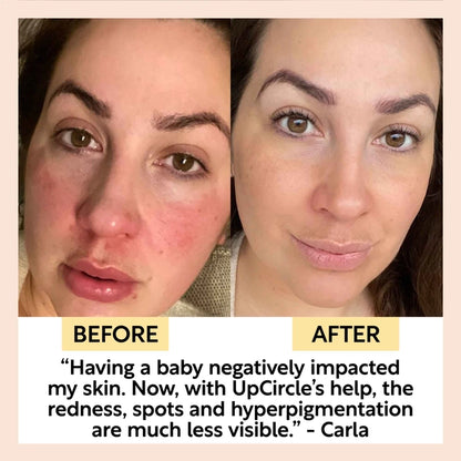 UpCircle Collagen Boosting Face Serum with Coffee and Rosehip