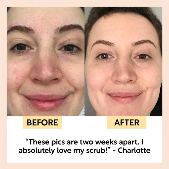 UpCircle Beauty Face Scrub with Coffee + Rosehip - Floral Blend for Sensitive Skin