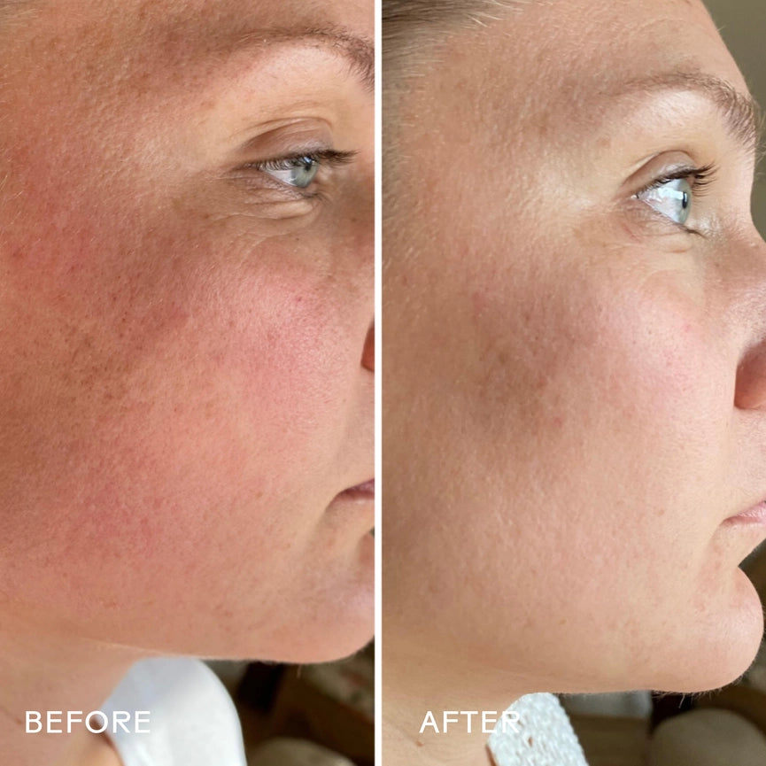 Three Ships Skin Hero Calendula + 2% Bakuchiol Bio-Retinol Serum